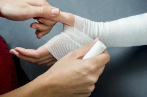 doctor bandaging a womans hand injured by dog bite